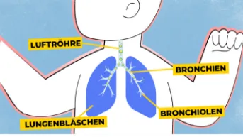 Das Immunsystem des Säuglings wird durch RSV aktiviert